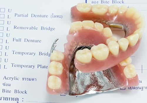Blog Image 1